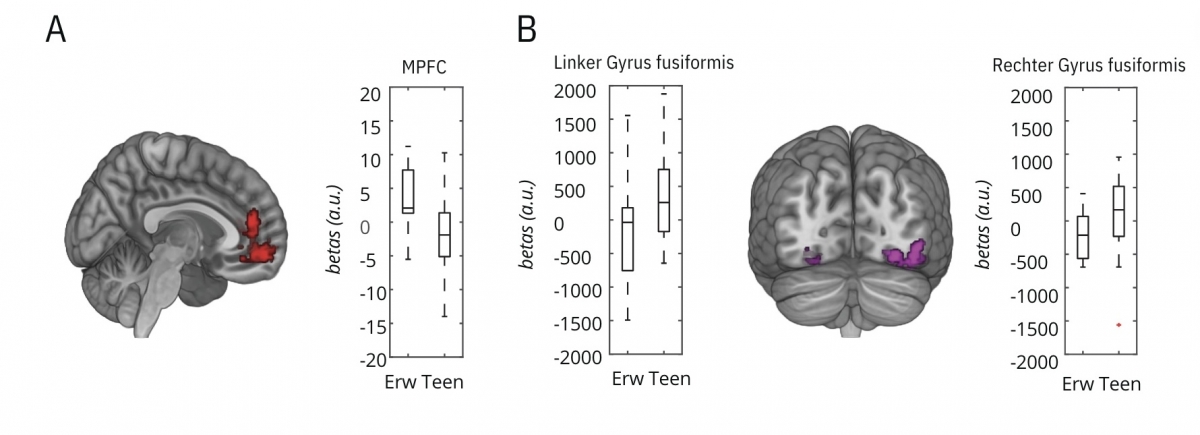 Bild 3: Die fMRT-Ergebnisse im Vergleich